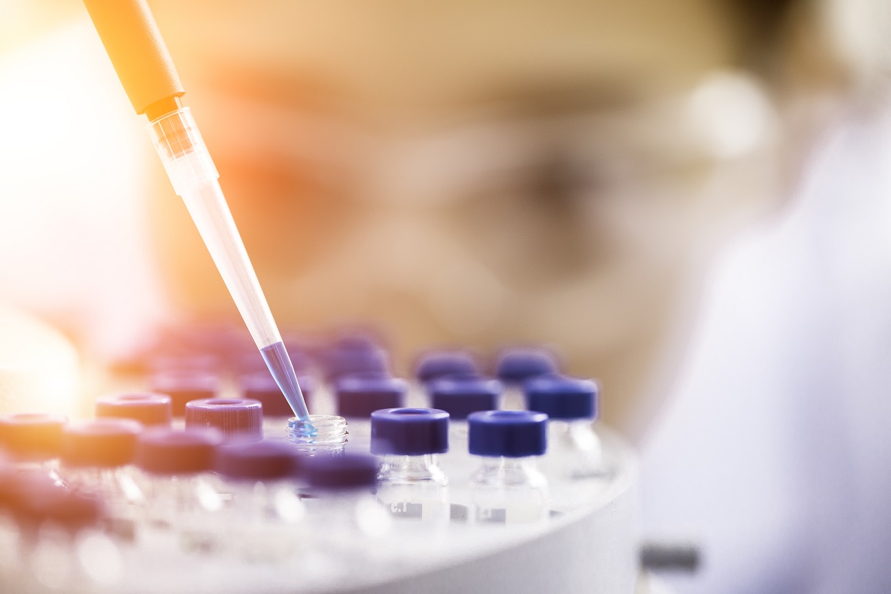 Close up of test tubes being filled